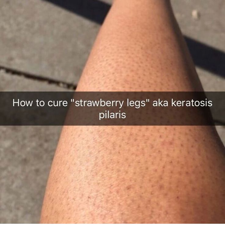 How do you get rid of instagram